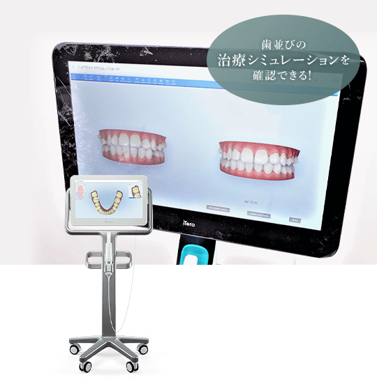 歯並びの治療シミュレーションを確認できる！