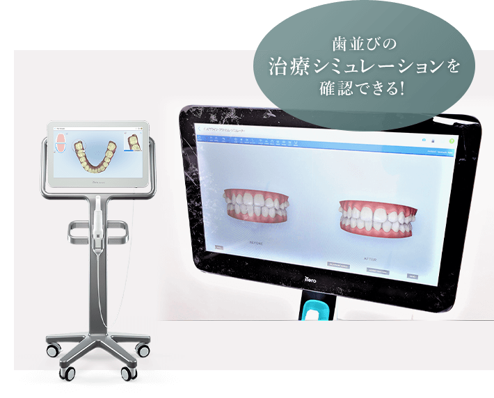 歯並びの治療シミュレーションを確認できる！